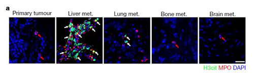转入小鼠模子获得相同的试验效果，且在转移爆发前NET已在肝脏聚积。