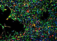 天下首创：药物将干细胞指导至受损部位，提高其愈合能力！