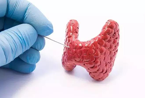 甲状腺疾病，包括甲状腺功效减退和甲状腺功效亢进，自古以来就是重复被医学研究职员研究的疾病
